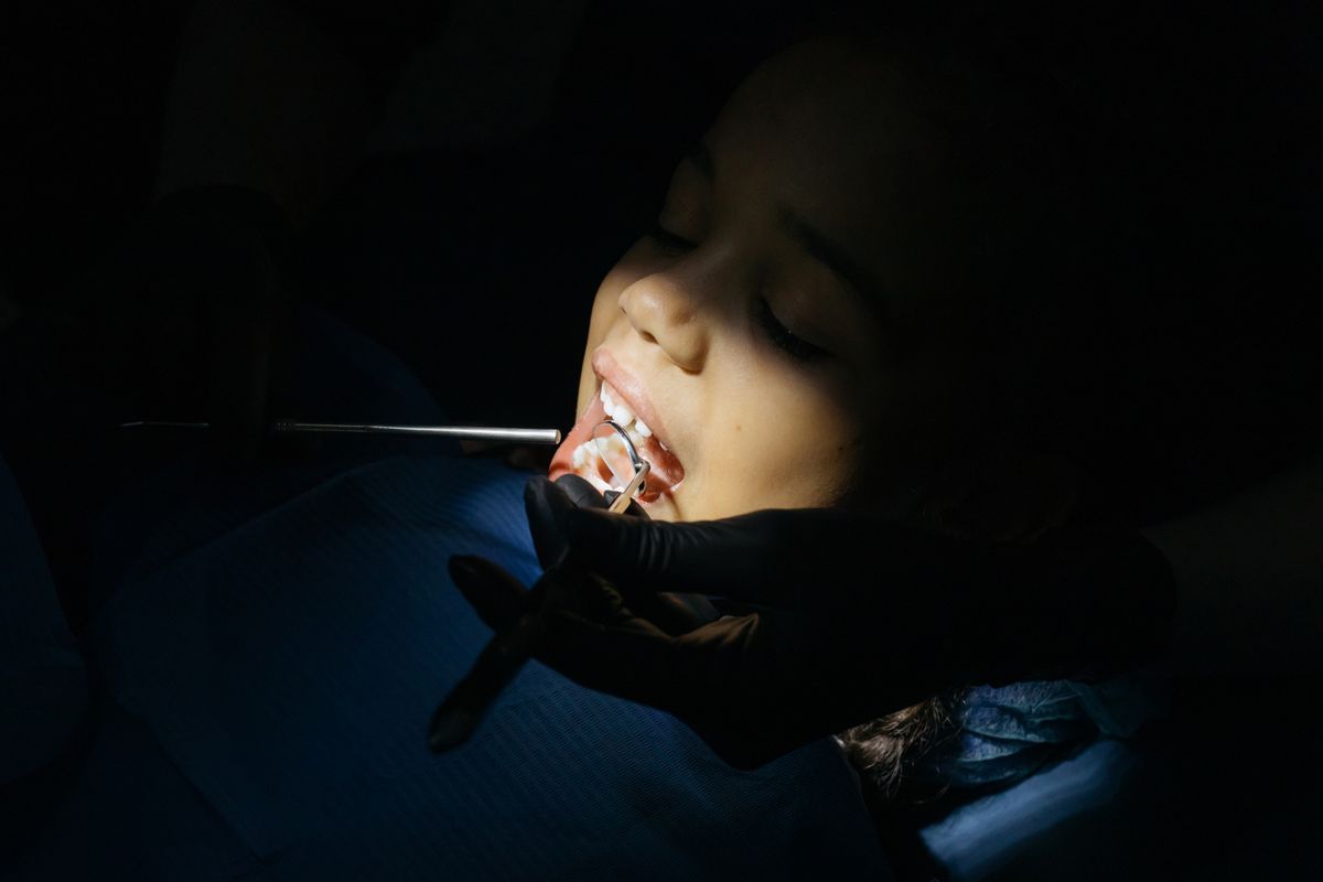 Dentist applying a sealant to a child's molar