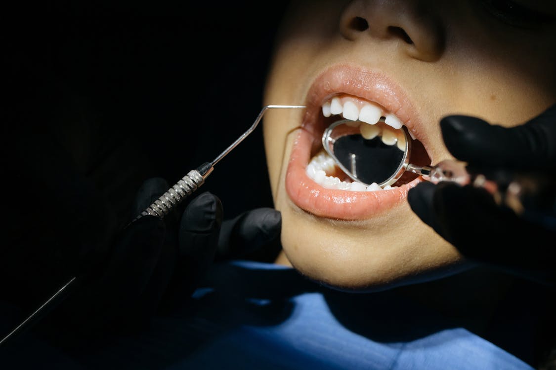 ▼一名網友到牙醫診所拔牙，事後竟發現舌下有破洞。（示意圖／pexels）