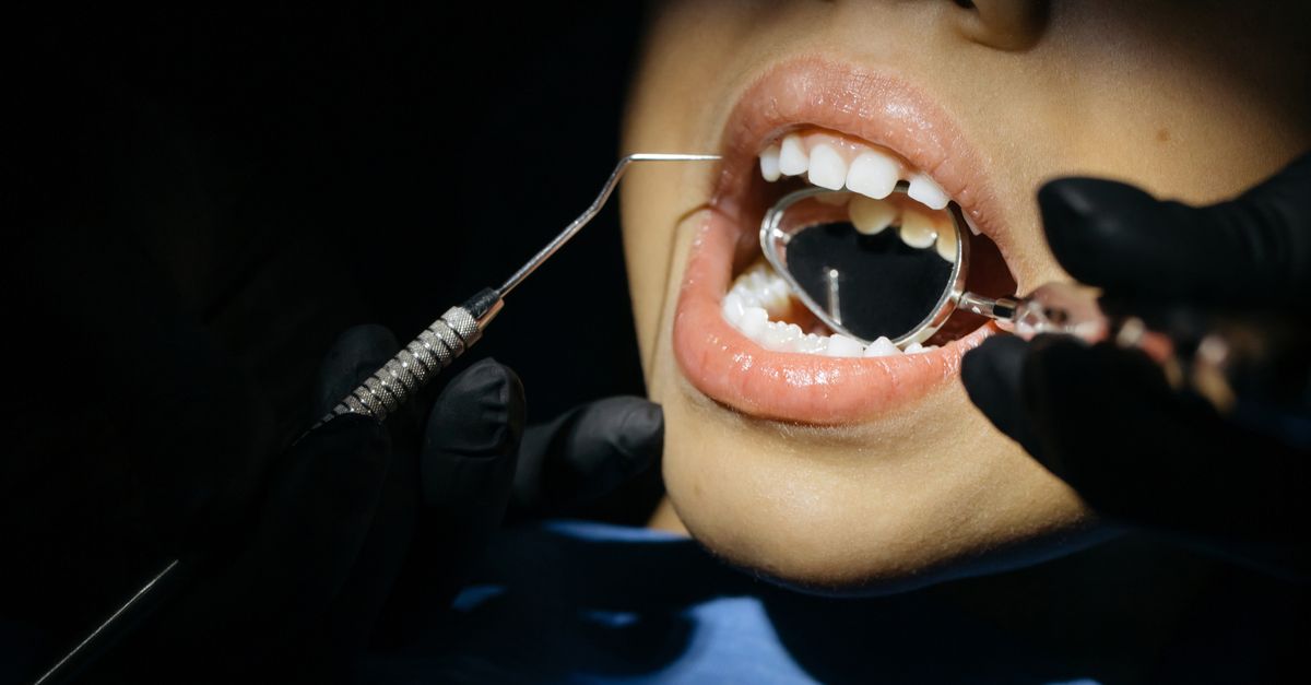 Why Children Resist Dental Visits So Vehemently (And What Actually Works for Stress-Free Checkups)