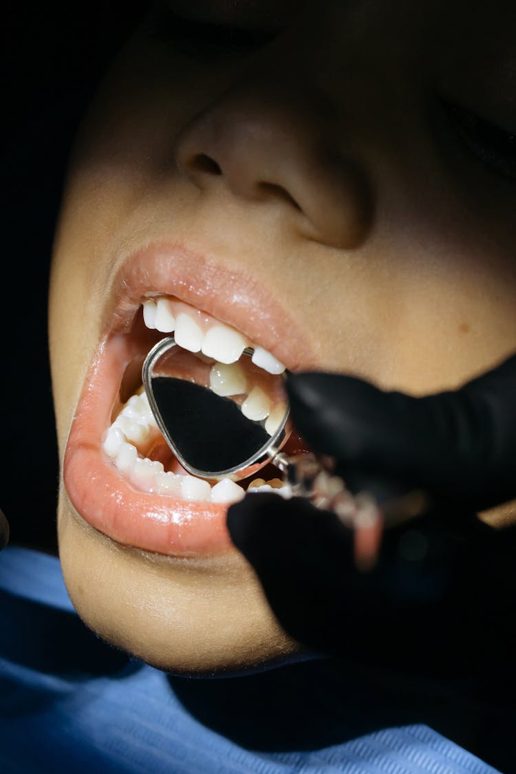 Close-Up Shot Of A Kid Having Dental Checkup