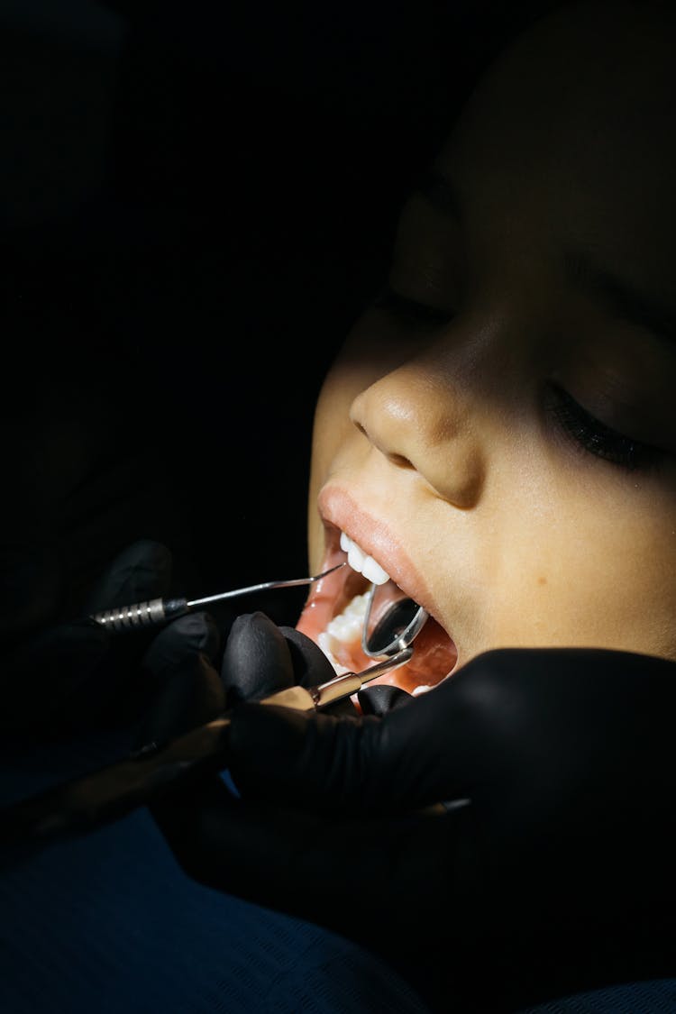 Close-Up Shot Of A Kid Having Dental Checkup