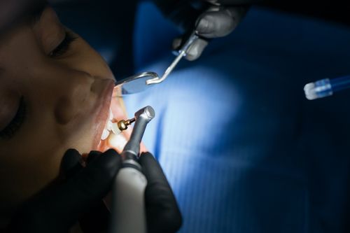 Free Close-up of a child receiving a dental checkup in a modern clinic with professional tools. Stock Photo