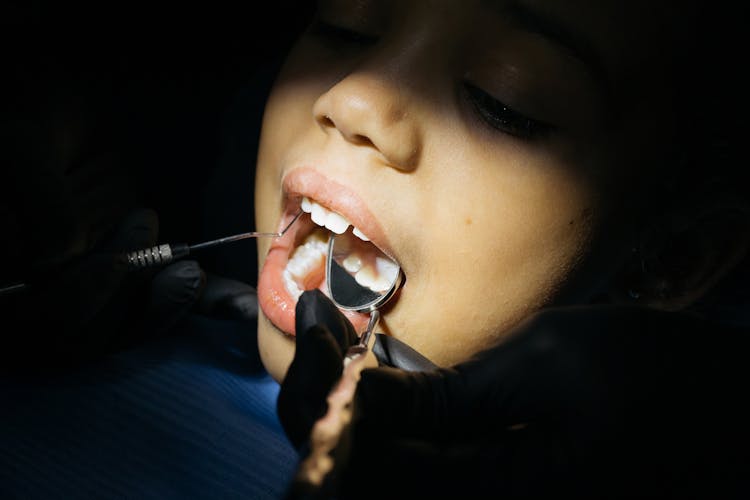 Close-Up Shot Of A Kid Having Dental Checkup