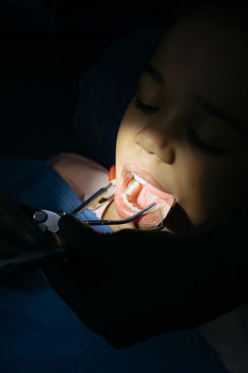Free Close-up of child during dental checkup in a clinic setting. Stock Photo