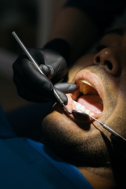 Free Close-up view of a patient undergoing a dental checkup with a mouth mirror in a clinic. Stock Photo
