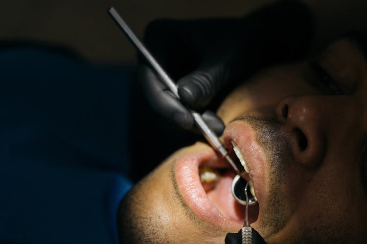 Close-Up Shot Of A Man Having Dental Checkup