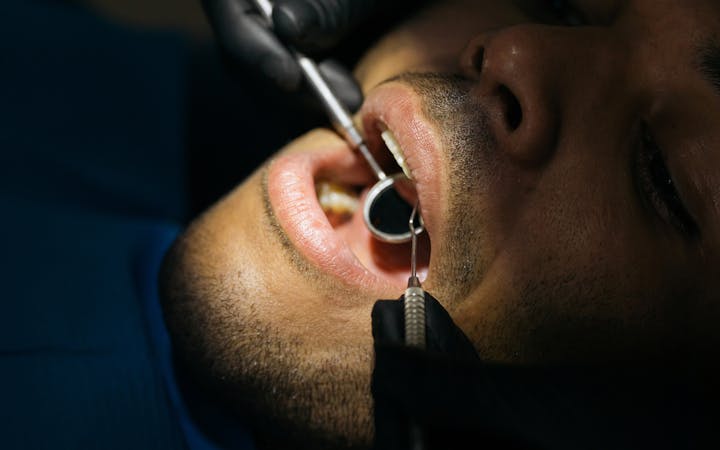 Detailed close-up of a dental examination with a mouth mirror and probe at a clinic.