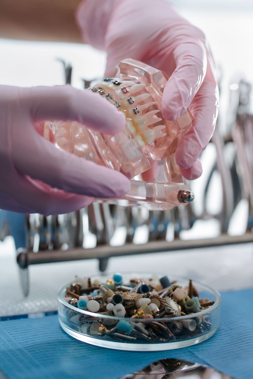 A gloved hand holding a model of a lower jaw and teeth in a dental office