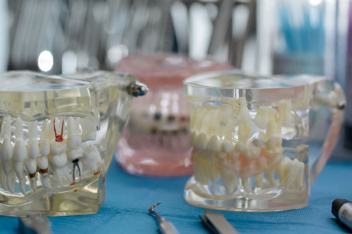 Dental models displaying crown and bridge restorations