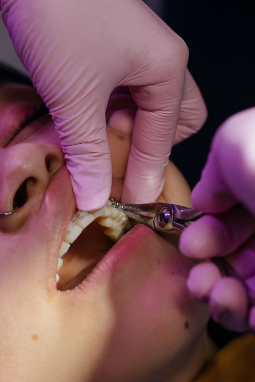A dentist examining a patient's teeth and gums using dental tools during a close-up oral exam