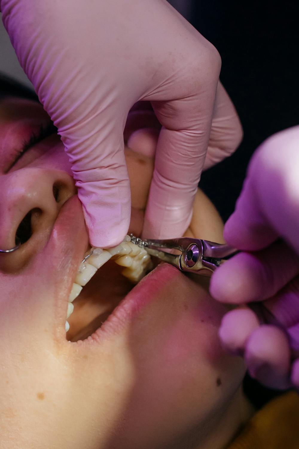Dentista mostrando una radiografía dental a un paciente