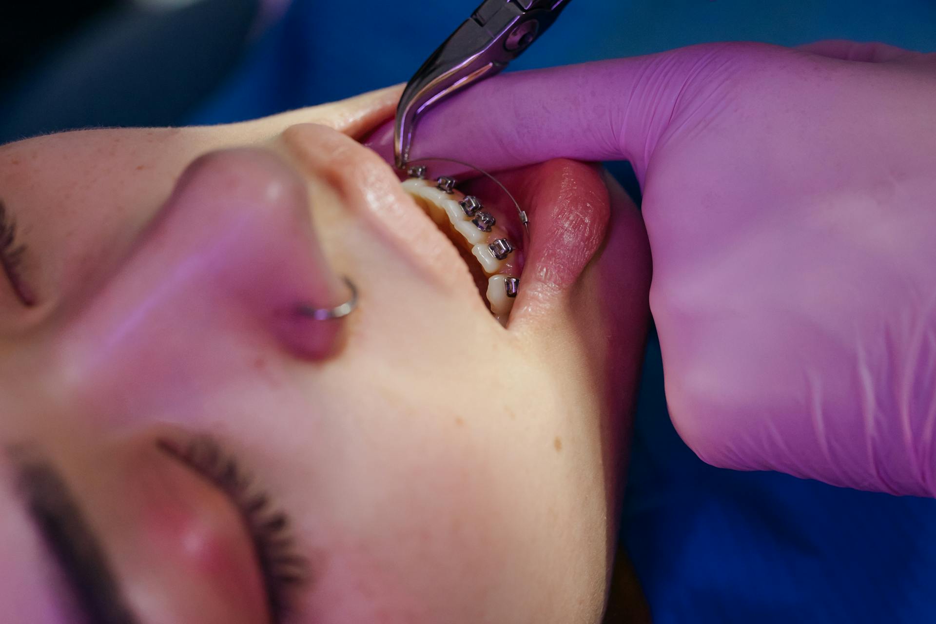 Photo de près d'un dentiste examinant les dents d'un patient