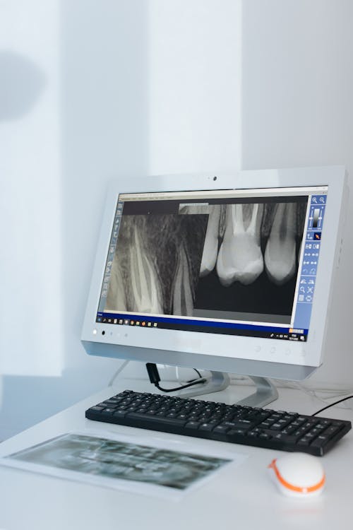 X-ray of Teeth on a Monitor 