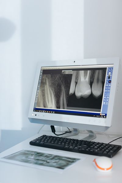 Radiografía dental en un monitor