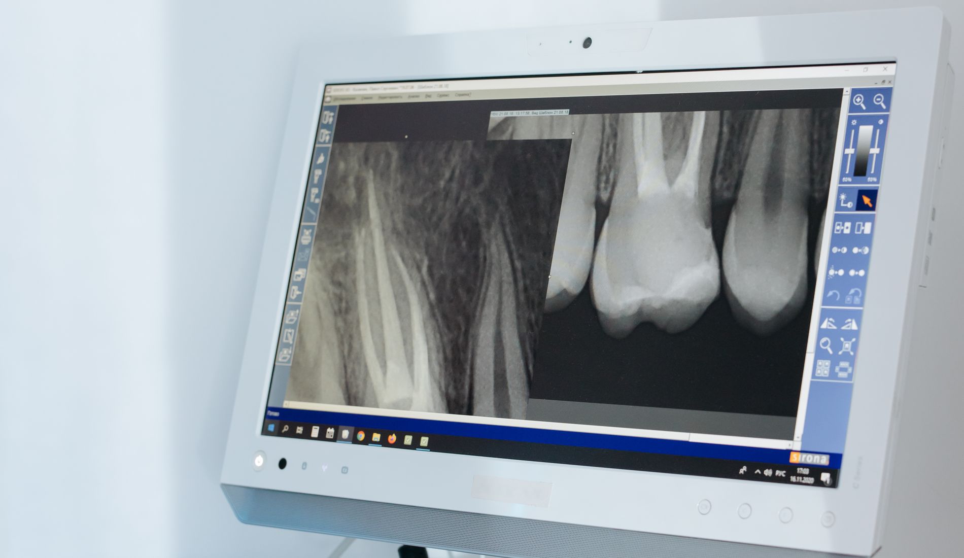 Dental materials disclosed at Ohud Dental, Lahore