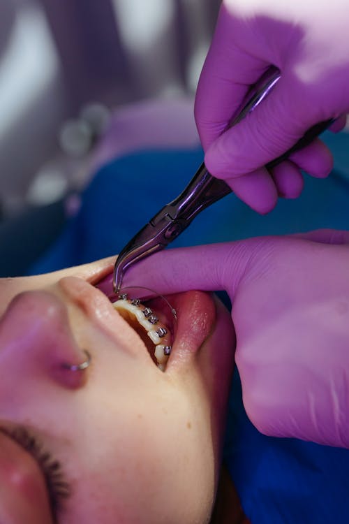 Close-up Photo of Dentist Examining Patient's Teeth