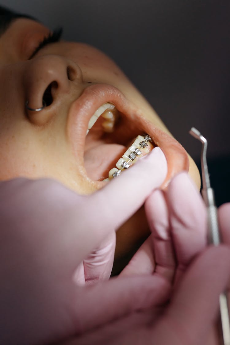 Patient Receives A Treatment From A Dentist