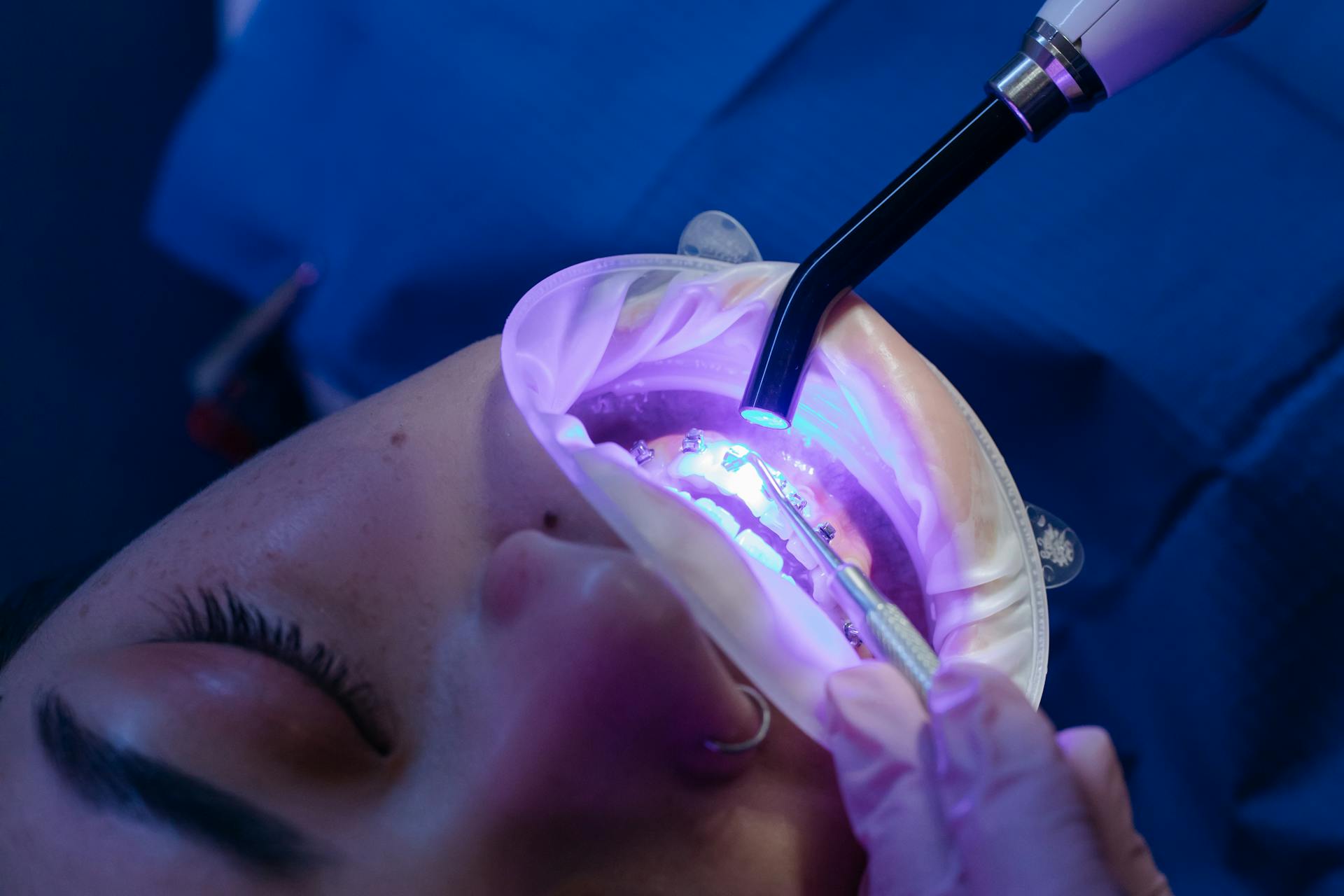 Patient having a Dental Treatment