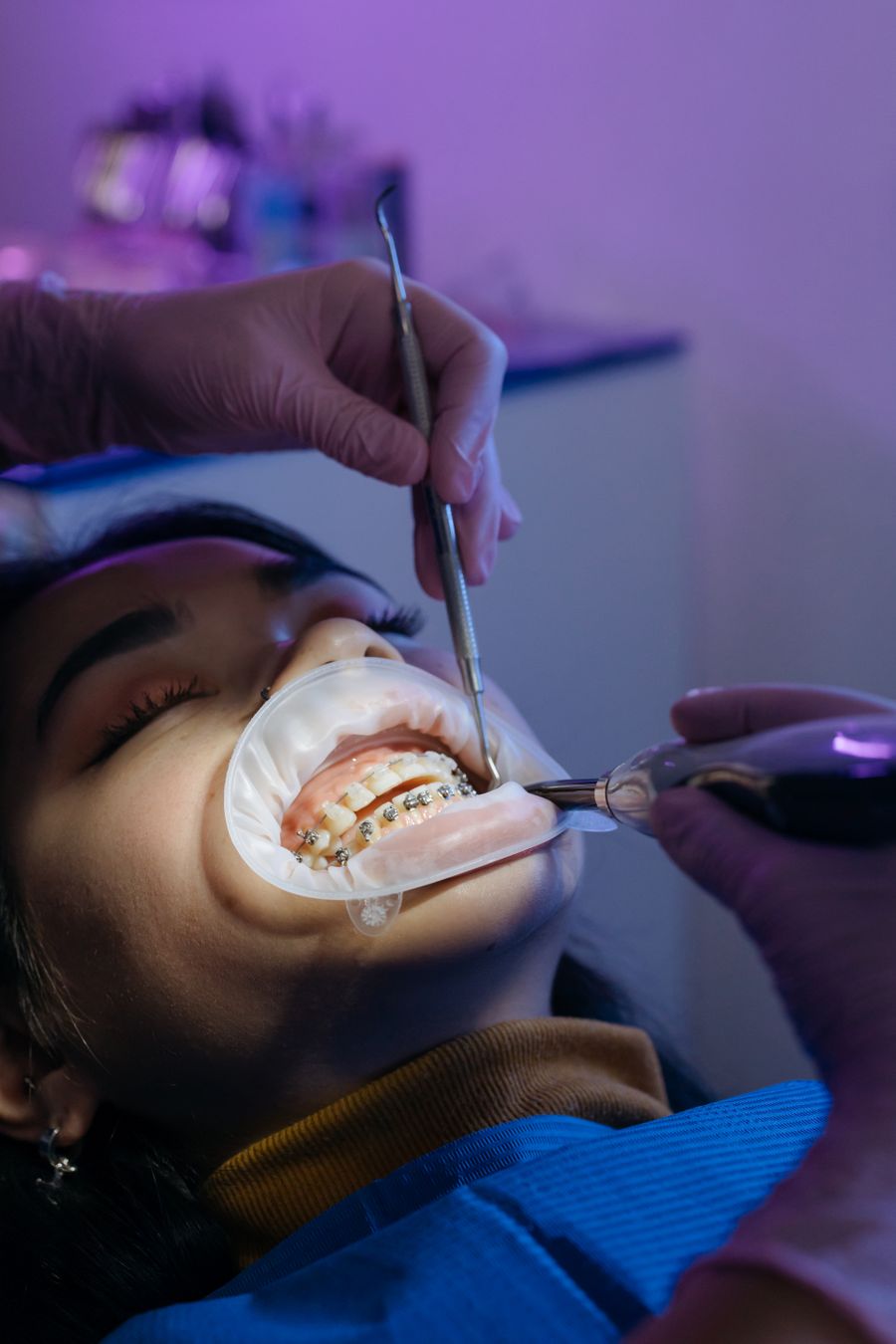 Orthodontic braces treatment in clinic