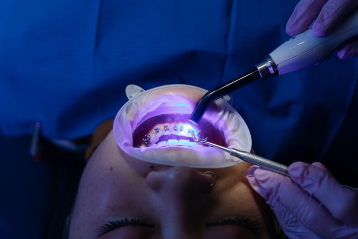 Dentist inspecting results of composite filling treatment
