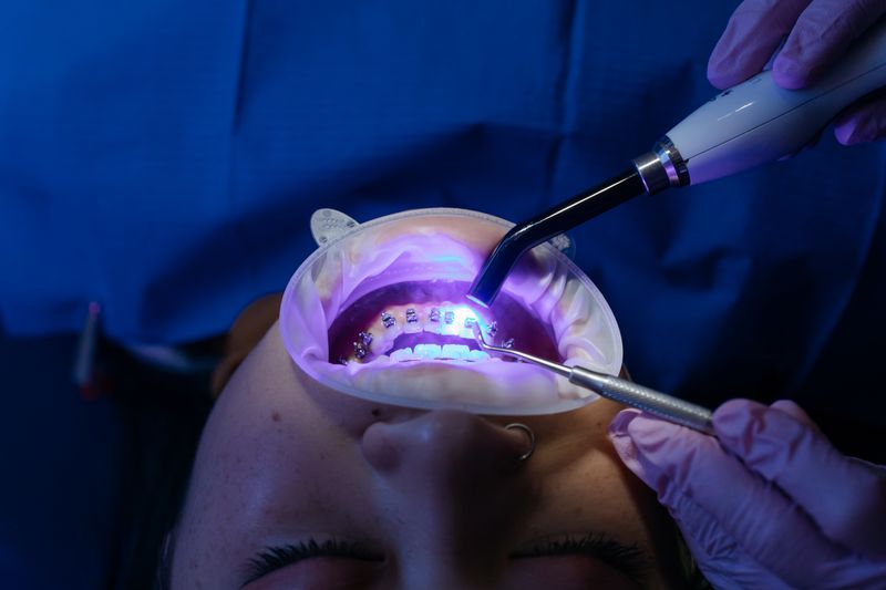 Cure dentali in Albania guida completa
