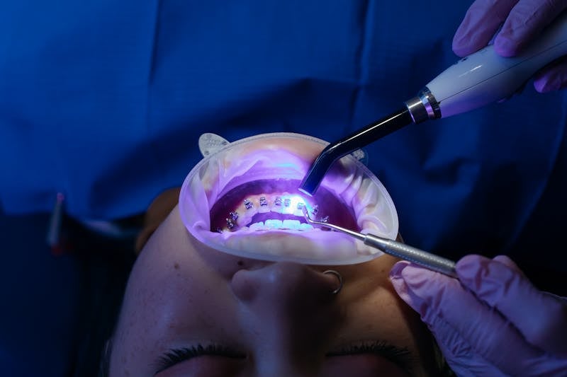 Patient dental treatment