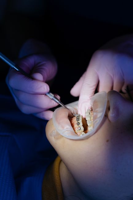 Dentist performing procedure on patient with braces, highlighting dental care.