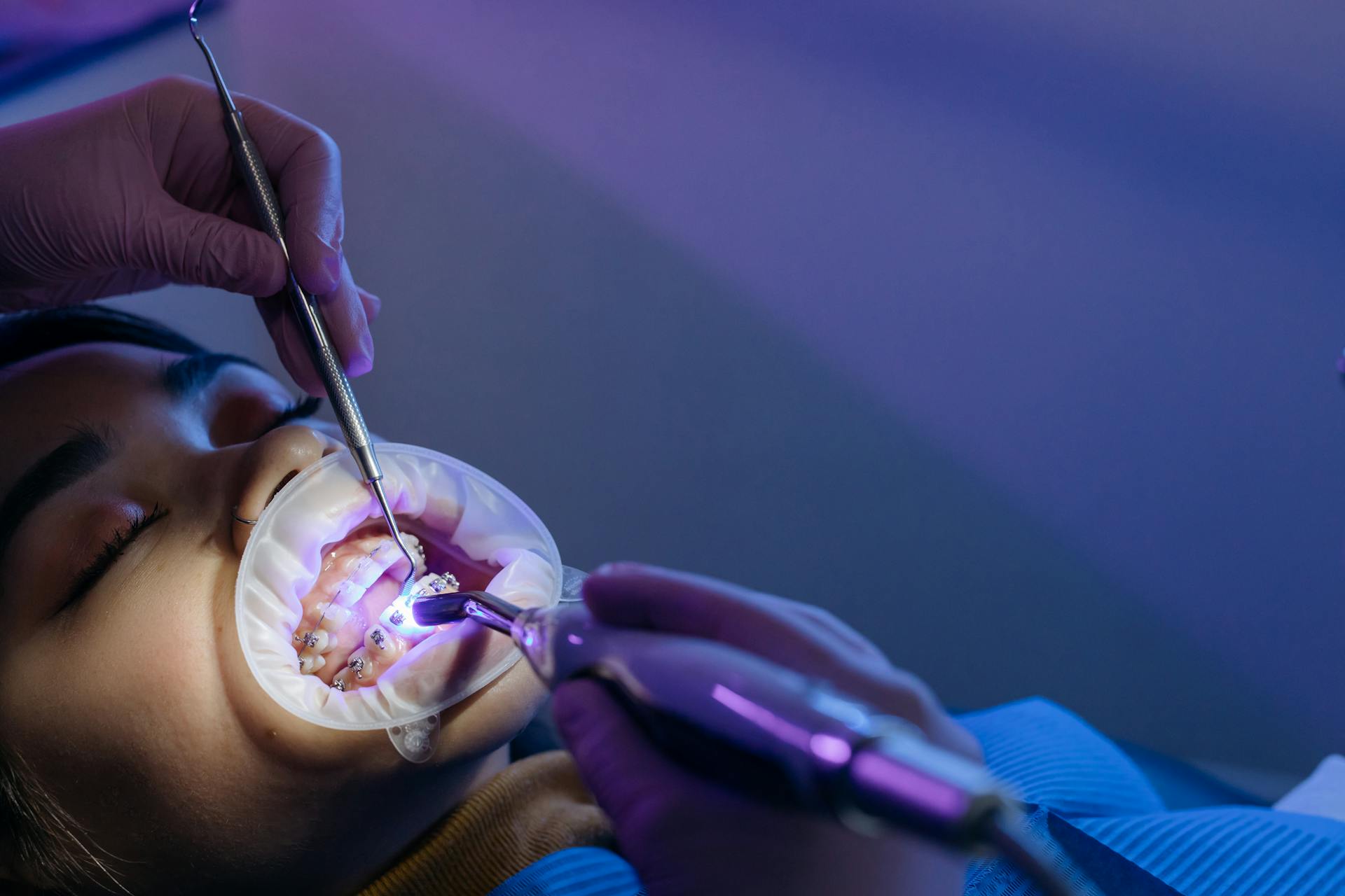 Close-up Photo of a Dental Treatment