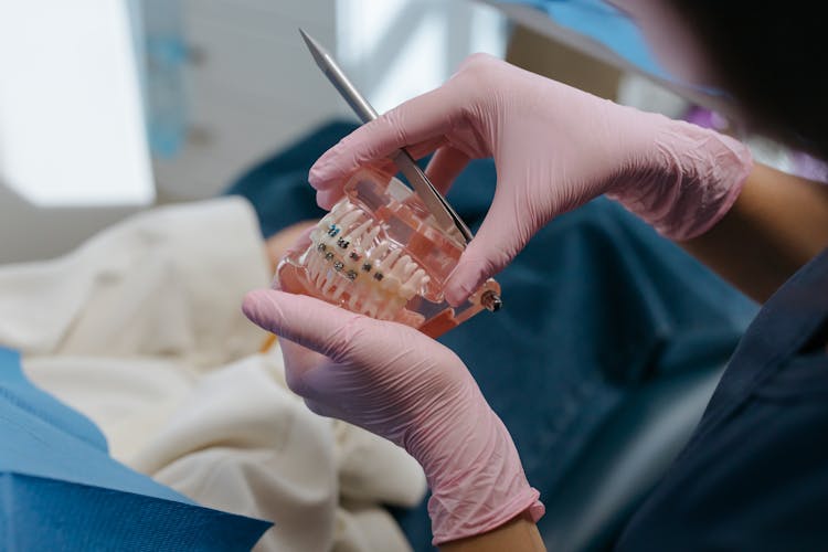 Cast Model Of Dentures