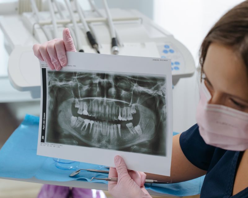 A dentist explaining a dental X-ray to a patient in a calm consultation