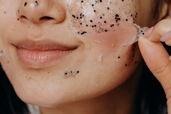 Dermaplaning