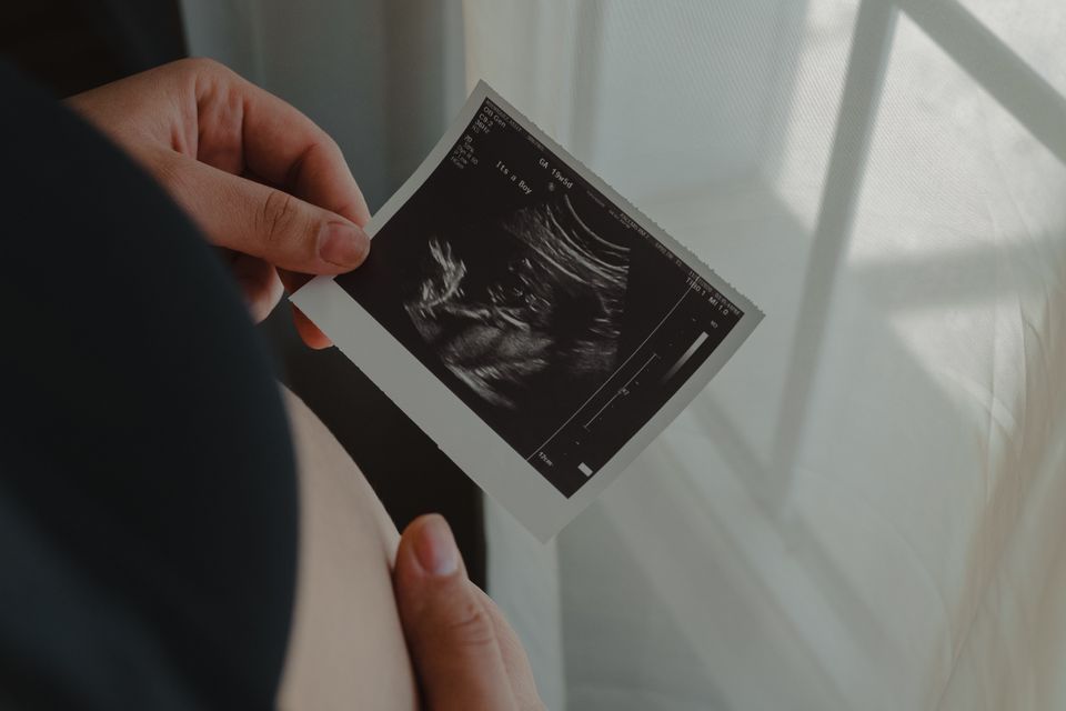 Woman holding an ultrasound scan image