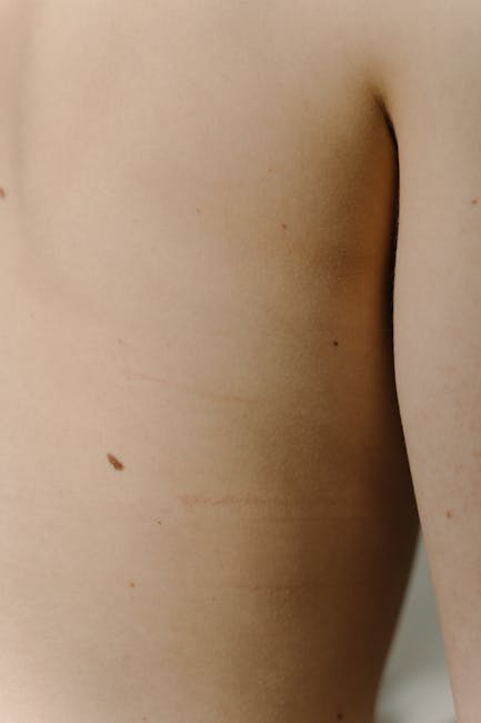 mole removal near me Del Aire mole removal Del Aire