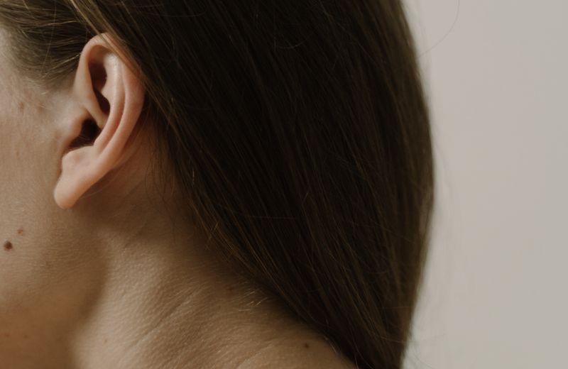Mole & Skin Tag Removal at Derma Skin and Hair Solutions