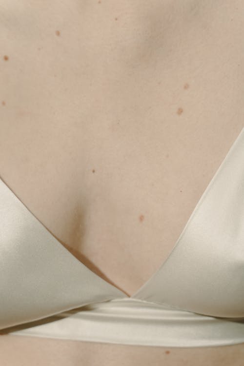 Moles on a Woman's Chest