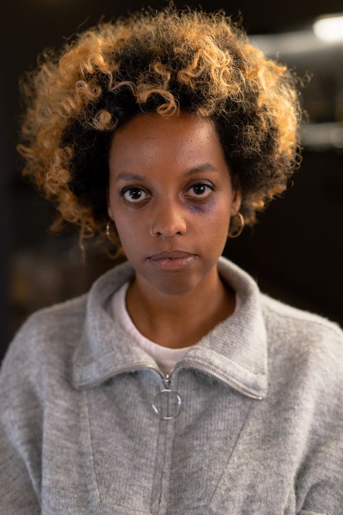 Free Close-up portrait of a woman with afro hair showing a bruise under her eye. Stock Photo