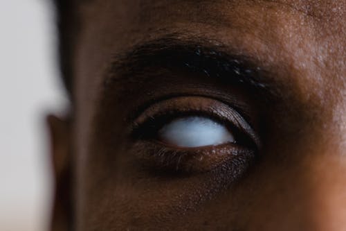 Free Close-up Shot of a Blind Eye Stock Photo