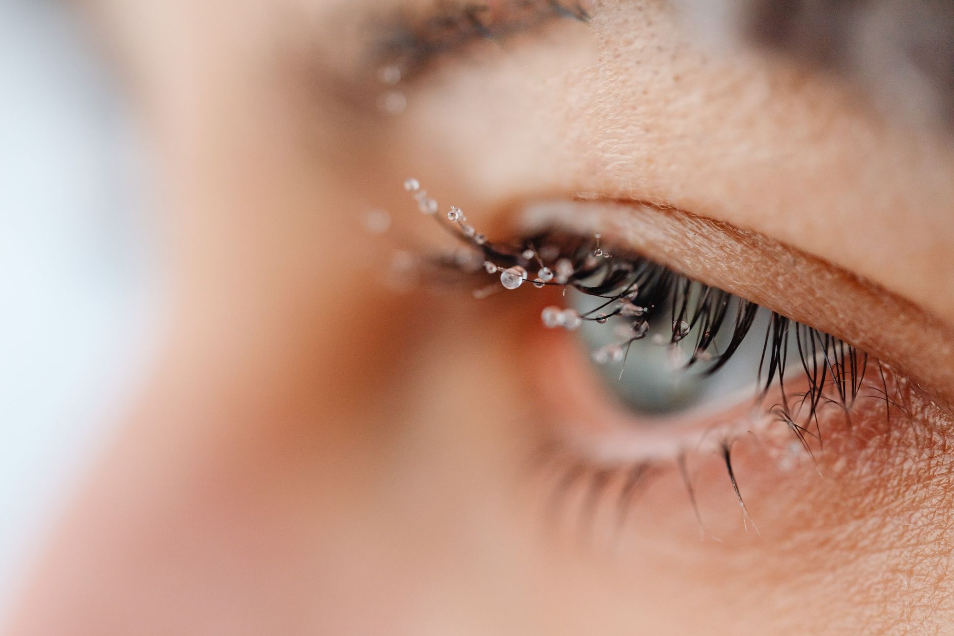 Blepharitis: Understanding and Managing Eyelid Inflammation