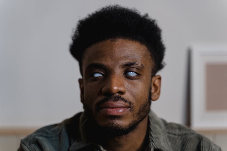 A Close-Up Shot Of A Blind Man