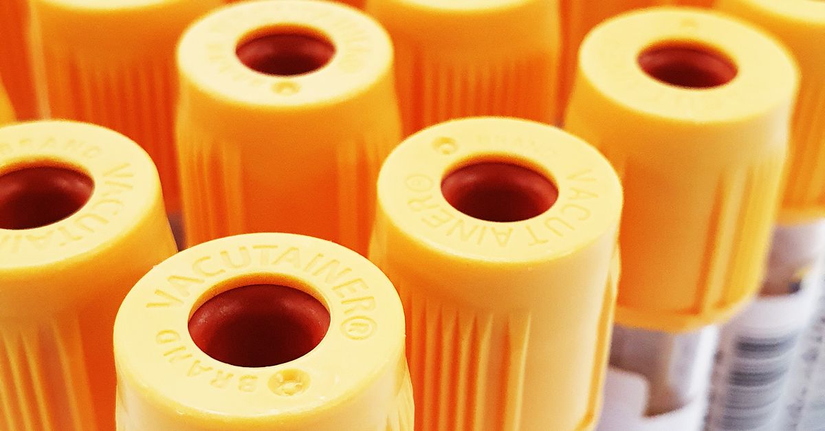 Yellow Blood Sample Blood Samples in Test Tubes with Yellow Caps · Free Stock Photo
