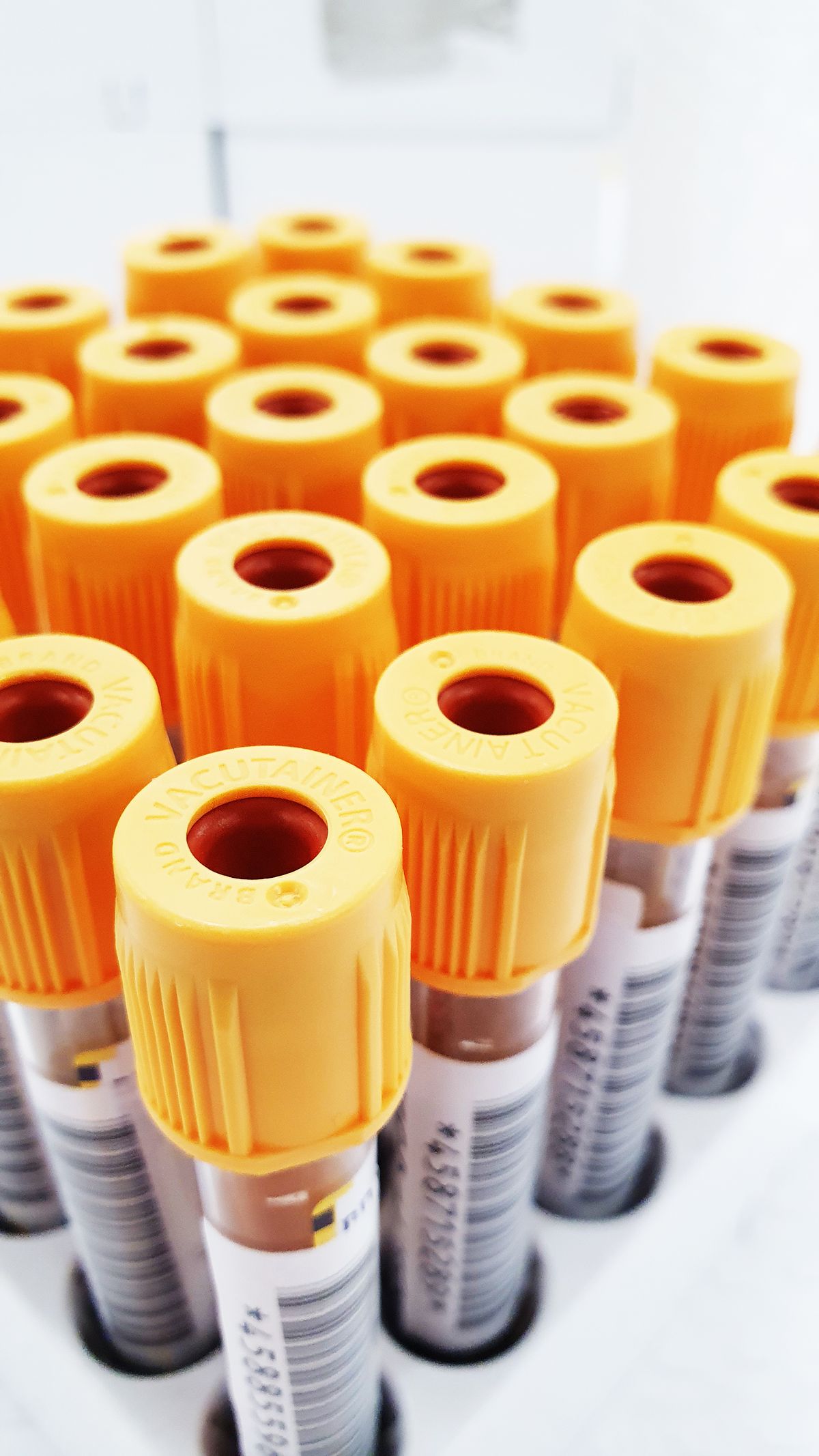 Blood sample tubes with yellow caps, ready for testing