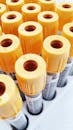 Blood Samples in Test Tubes