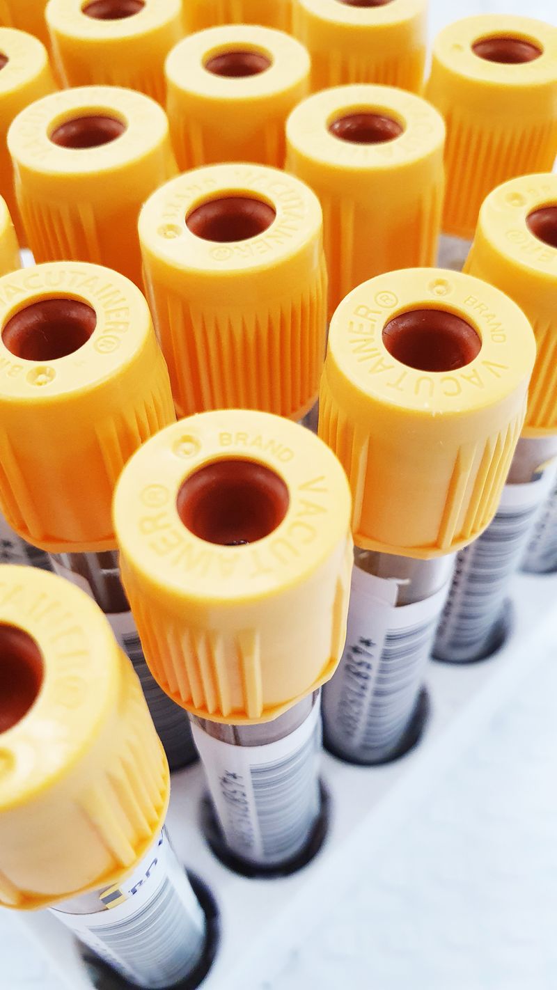 Blood collection tubes organized by order of draw