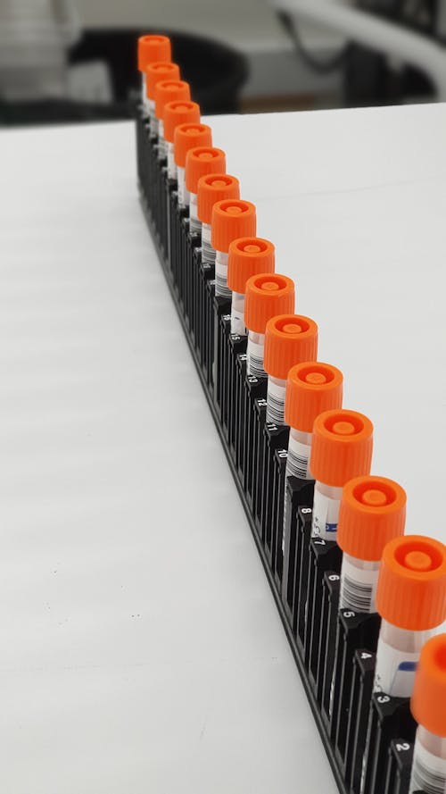 Free Blood Samples in Test Tubes in a Row Stock Photo