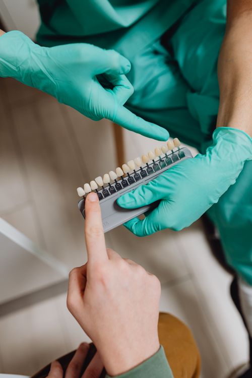 Free Close-up of hands holding a tooth shade guide in a dental setting. Stock Photo