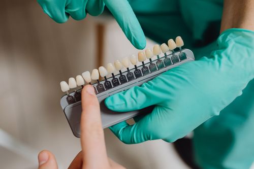 Free Dental professional with gloves pointing to a dental shade guide in a clinic. Stock Photo