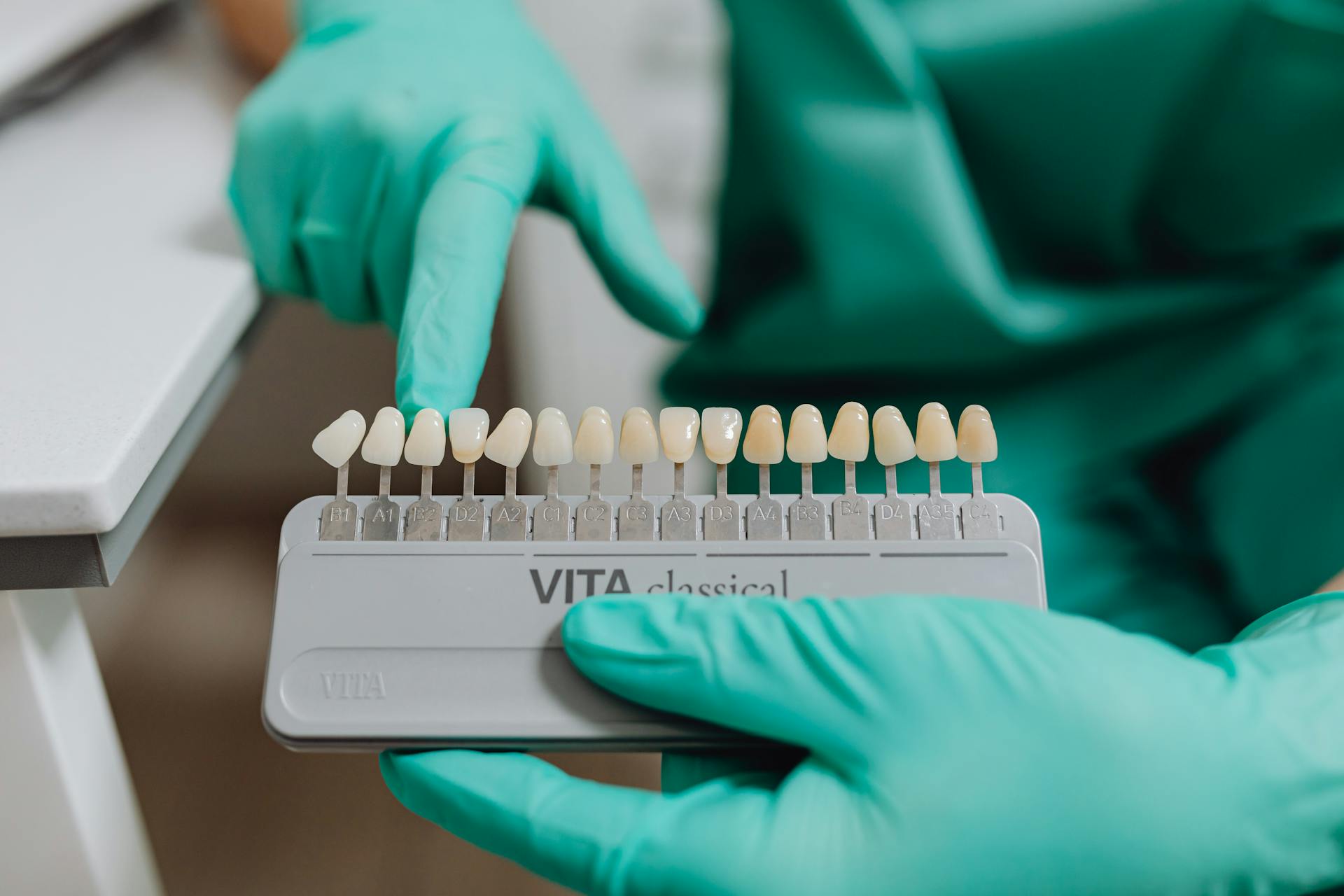 A Dentist Holding a Dental Shade Guide