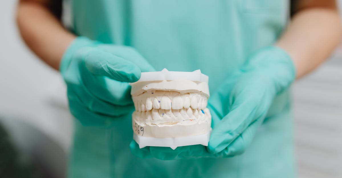 Close-up Photo of Dental Cast · Free Stock Photo
