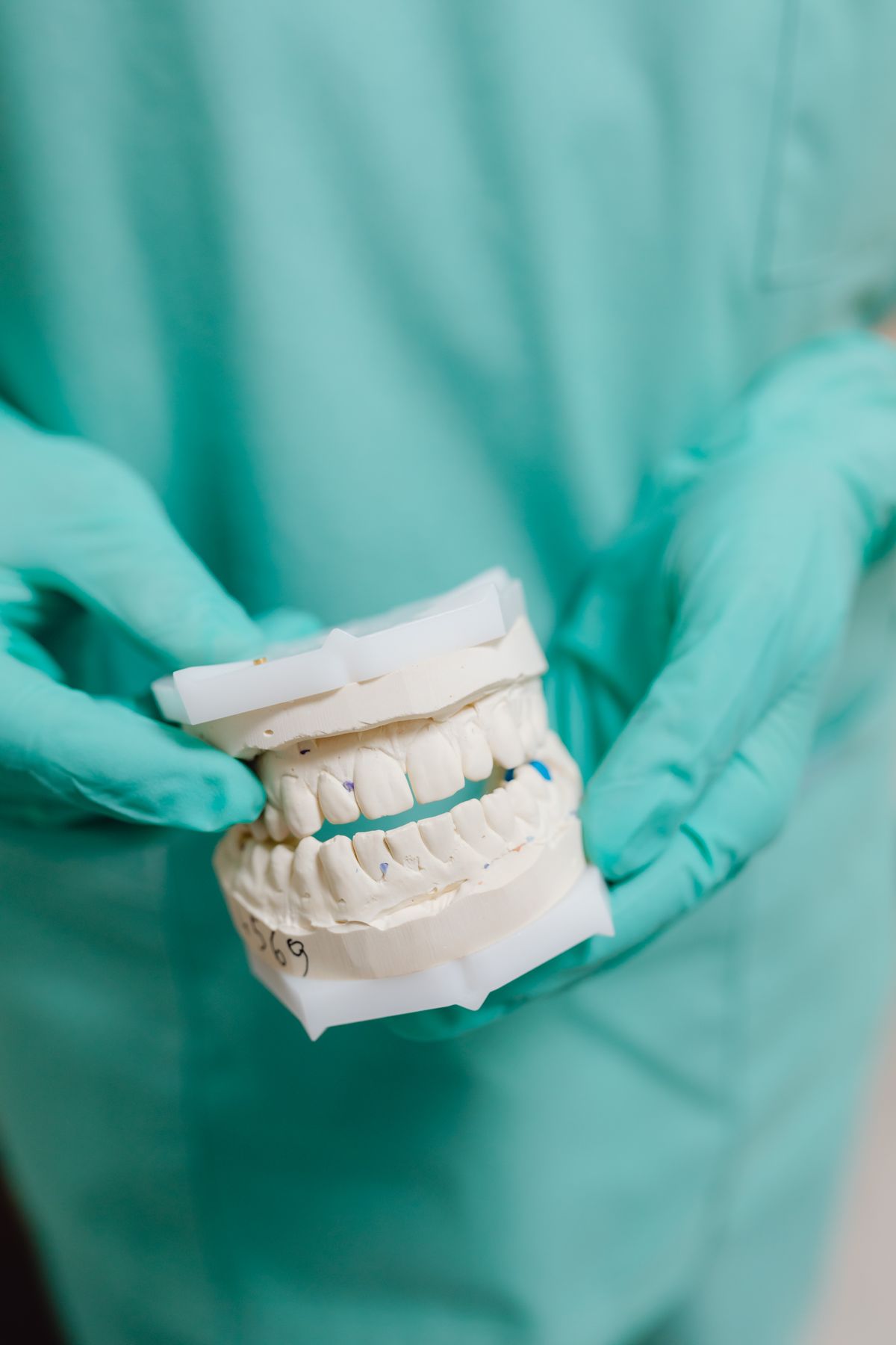 Dental implant model showing surface detail