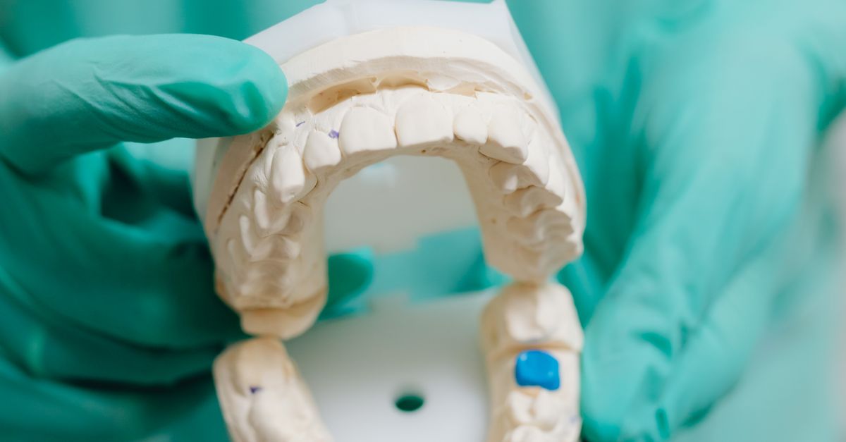 Cast For Tooth A Dentist Holding a Dental Cast · Free Stock Photo